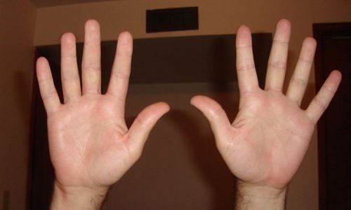 Tại sao con người có 10 ngón tay?